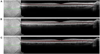 Foveal Phase Retardation Correlates With Optically Measured Henle Fiber Layer Thickness